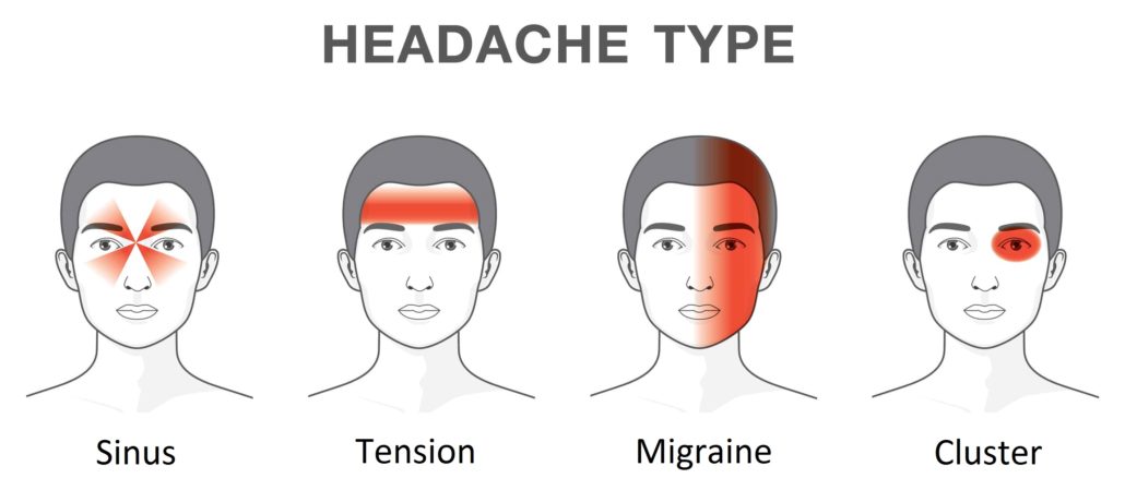 types of headaches